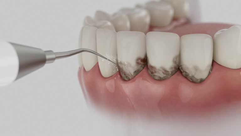 Trusted Teeth Cleaning And Checkup service in West Monroe, LA - Dentist Open Now